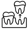 Chirurgie Orală – serviciu stomatologic DentAtelier Timișoara